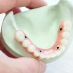 teeth_arch